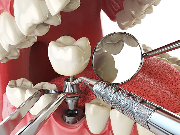 Best Dentist Open Late Near Me  in Mount Vernon, OH